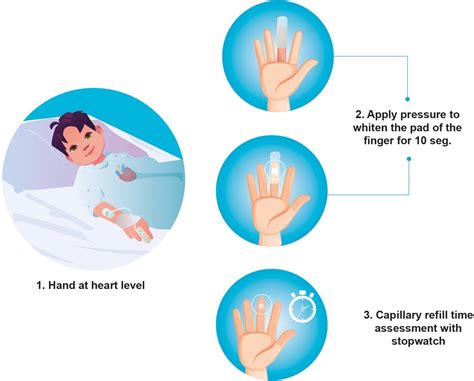 how to grade capillary refill